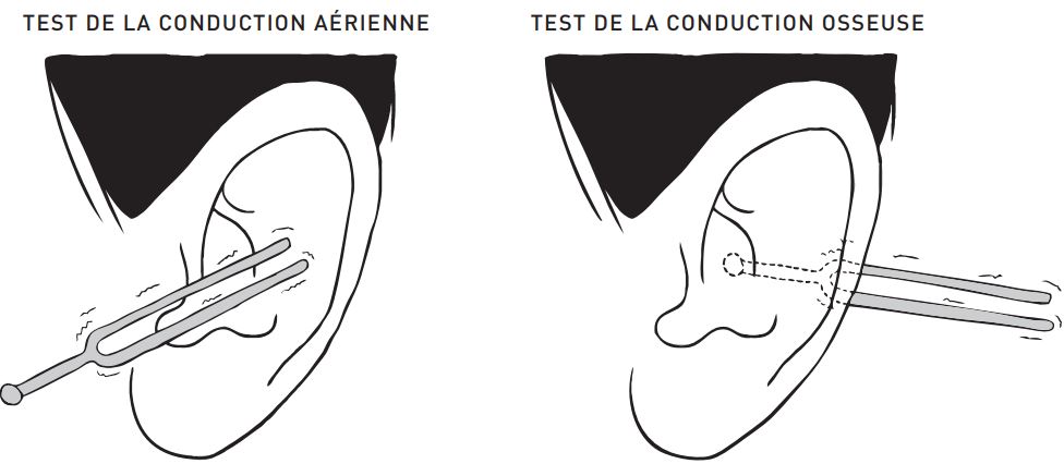 Examen médical de l'oreille avec diapason et otoscope