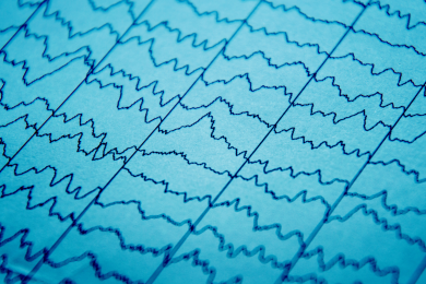 étude sur la capacité à décoder la structure rythmique de l’information auditive - bébés prématurés - Pr Fabrice Wallois