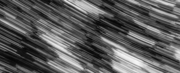 Surdité de perception : des sons mal interprétés par le cerveau