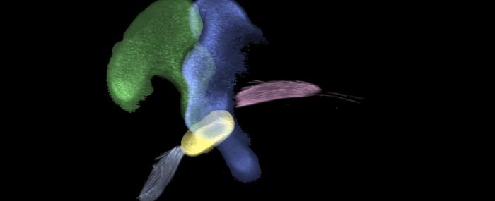 Hearing Innovation Chairs - Projet Alain Chédotal