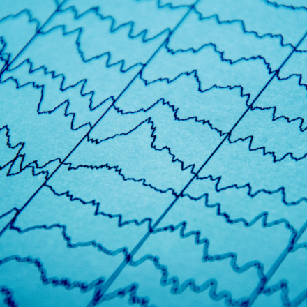Le cerveau des prématurés peut déjà décoder les rythmes